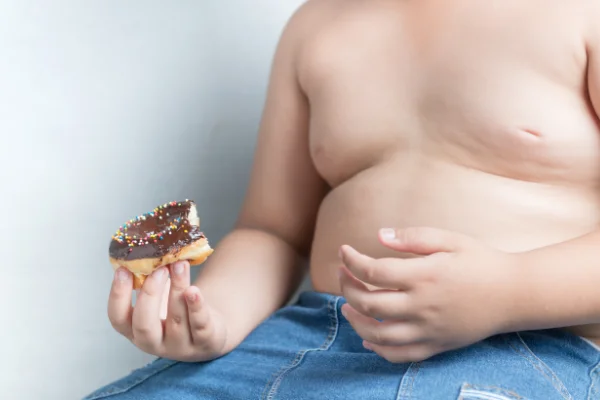Alimentazione Obesità infantile